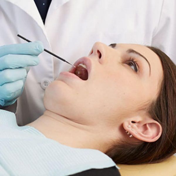 microbrush-x-extended-reach-applicator-clinical-close-px100-600x600 Young Innovations