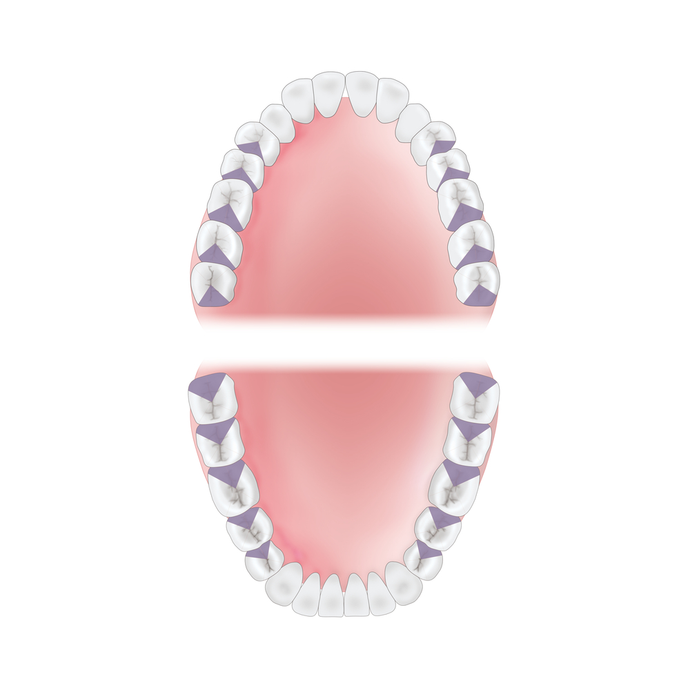 mouth-area-distal Young Innovations