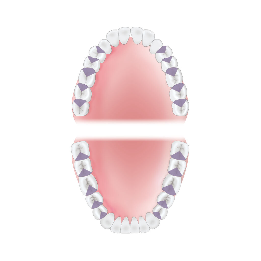 mouth-area-mesial Young Innovations