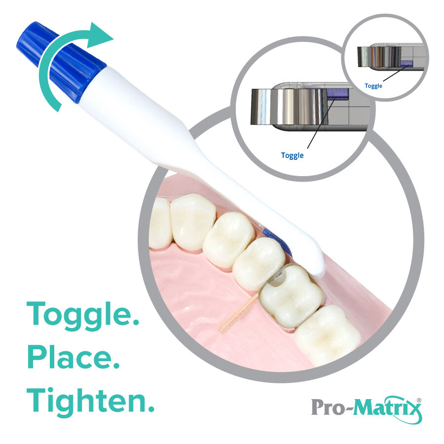 pro-matrix-toggle-demonstration-900x900jpg Young Innovations