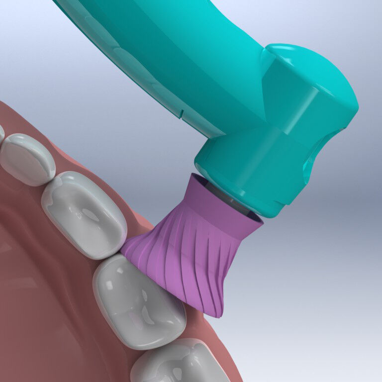 young-contra-elite-original-latex-free-prophy-angle-in-use Young Innovations
